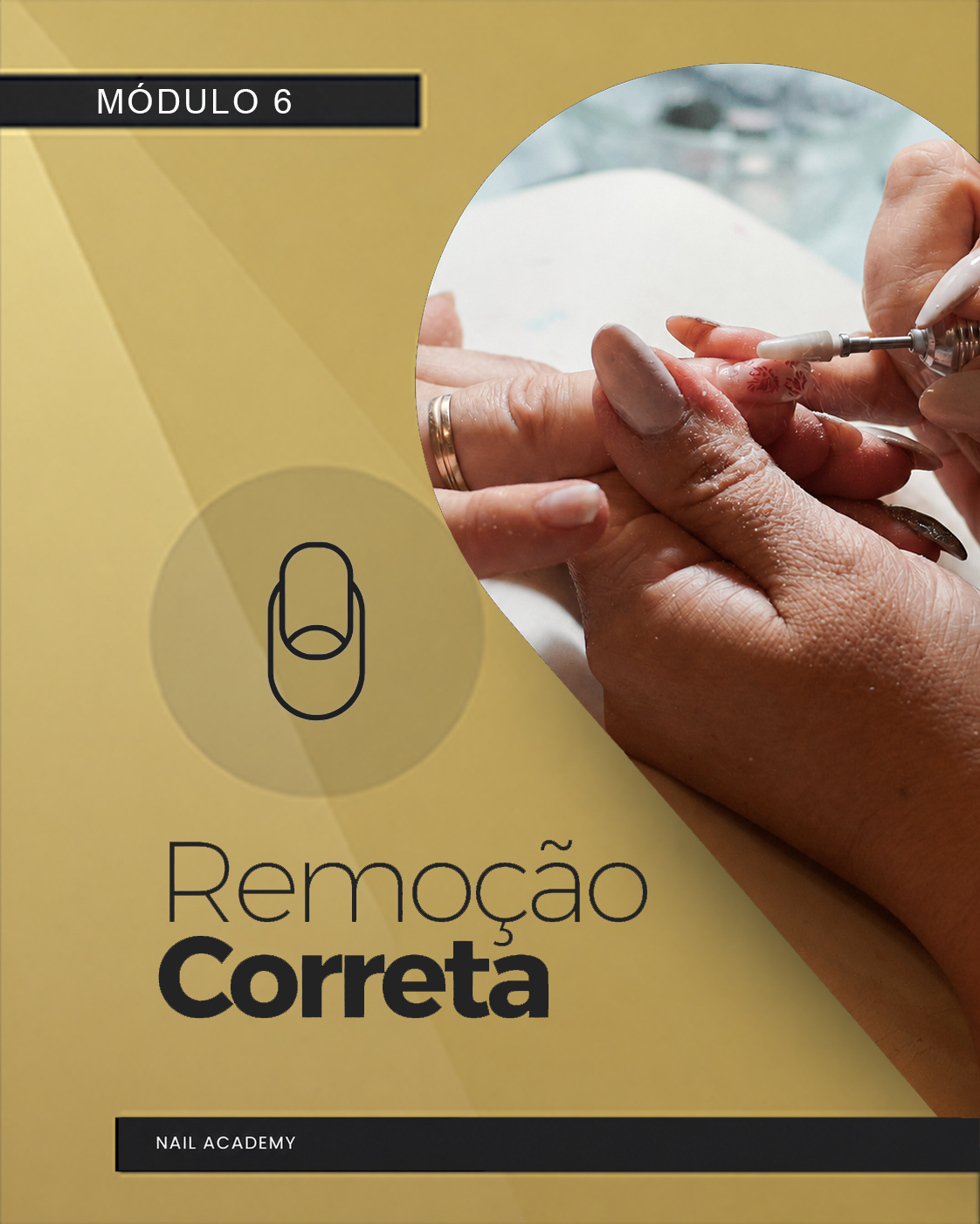 Mockup do módulo Remoção correta