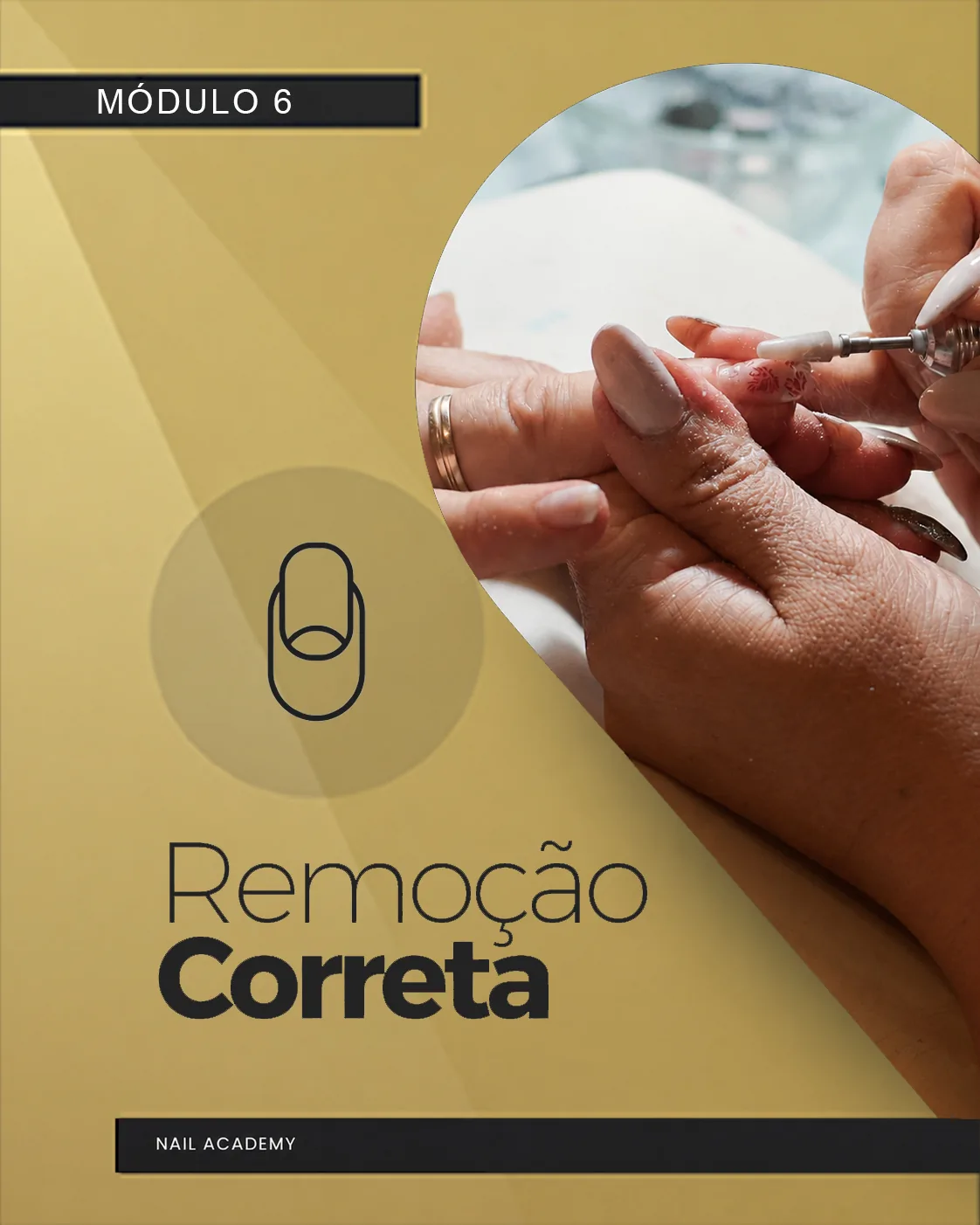 Mockup do módulo Remoção correta